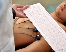 EKG készítése sportorvosi vizsgálathoz