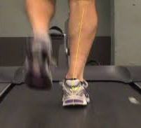 Dinamikus lábvizsgálat: járás/futás elemzés