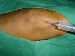 elektromágneses ízületi kezelés kenőcsök carpalis arthrosis kezelésére